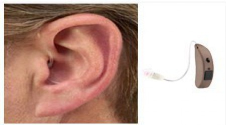 Receiver in the Ear (RIE) by Sparsha Speech & Hearing Clinic