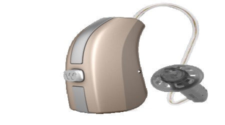 Widex Beyond Hearing Aid , B110 F2 RIC BTE by Shri Ganpati Sales