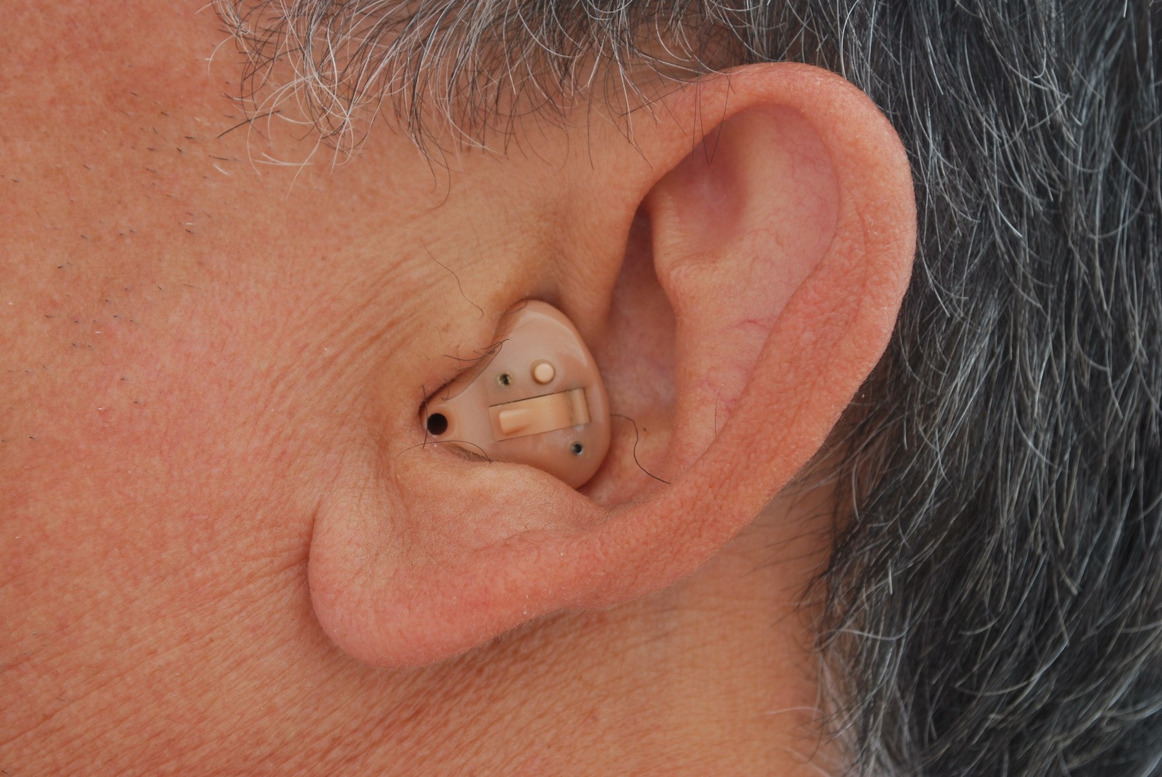 Ear hearing. Внутриушной слуховой аппарат Phonak. Усилитель слуховой аппарат внутриушной. Внутриушные слуховые аппараты (ite). Внутриушный слуховой аппарат у301 с МР.