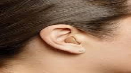 Siemens Itc Hearing Aid by Vertex Hearing Care